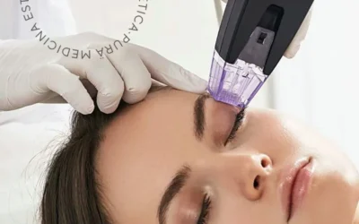 Morpheus 8 y Dermapen Médico: Innovación y Arte en Rejuvenecimiento Facial